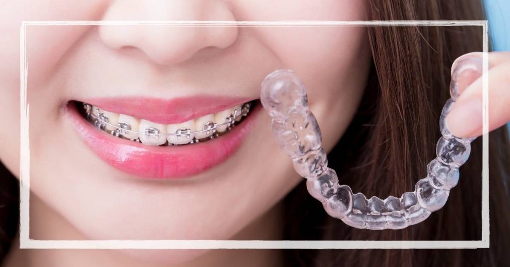 a person smiling with traditional metal braces on their teeth, holding a clear aligner tray for comparison.