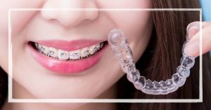 a person smiling with traditional metal braces on their teeth, holding a clear aligner tray for comparison.