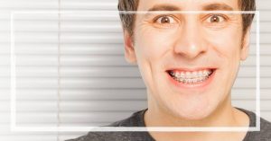 a smiling person wearing metal braces with a power chain connecting brackets for orthodontic tooth alignment