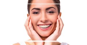 a smiling person wearing clear braces with hands supporting cheeks, highlighting improved dental alignment.