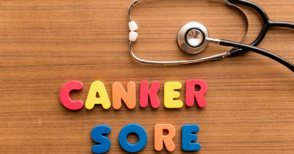 a stethoscope resting on wooden surface beside colorful block letters spelling "canker sore"