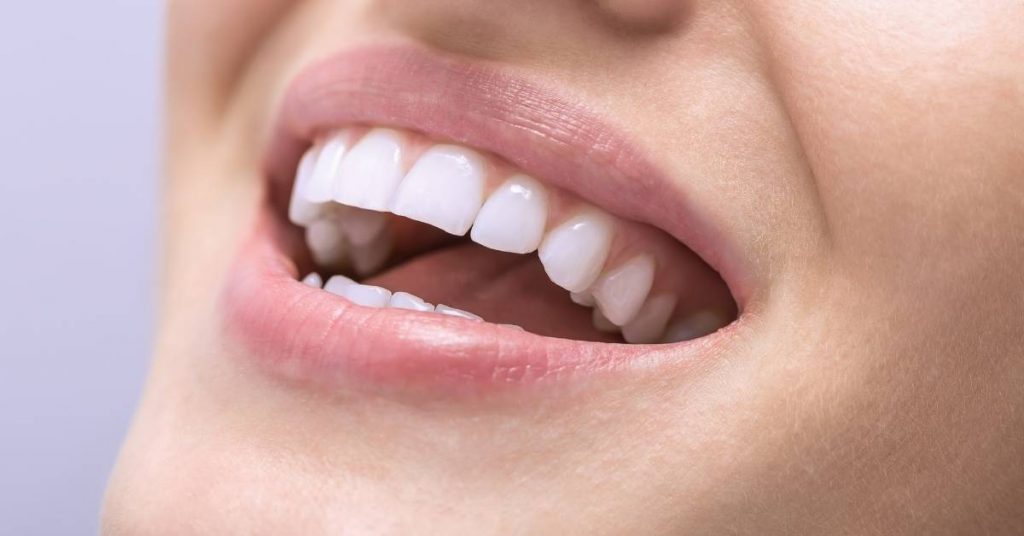 a person smiling with visible asymmetrical teeth alignment and a slight midline misalignment.