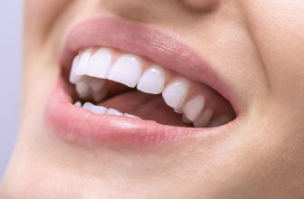 Asymmetrical Teeth Alignment: Causes & Treatment | Best Guide