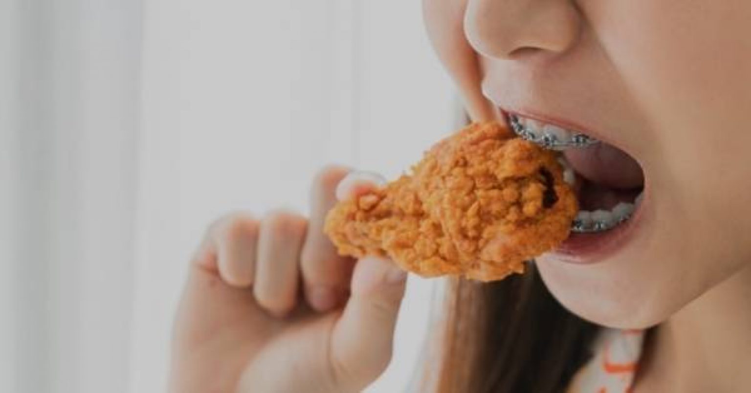 9 Chips You Can Eat With Braces Safely! Ultimate 2024 Guide