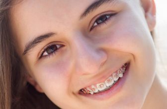 Can You Get Braces With Crown On Your Tooth? Best Guide