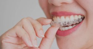 26 Celebrities Who Have Worn Invisalign Instead Of Braces