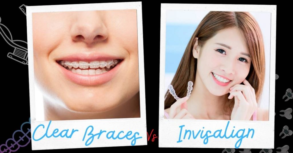 a comparative visual of clear braces on teeth next to someone holding Invisalign aligners, highlighting orthodontic treatment options.