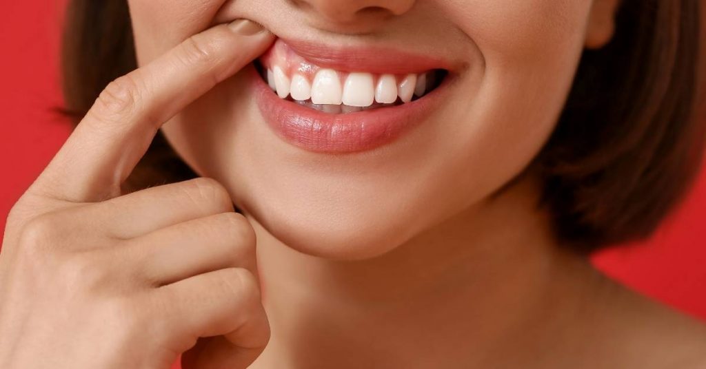 a person gently touching their finger to the corner of their mouth near a bright, healthy smile showing even, white teeth and pink gums.