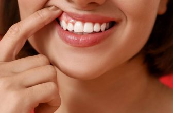 How To Treat Cut On Gums At Home Naturally | Best Guide For Quick Relief