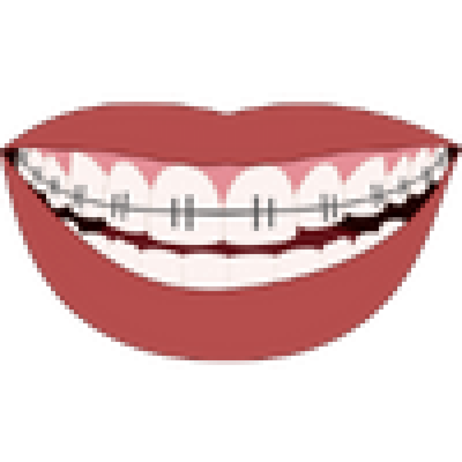 20 Reasons To Choose Black Braces Color Ultimate [year] Guide — free download