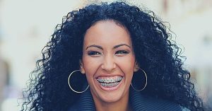 Do Braces Give You A Lisp? Ultimate Guide