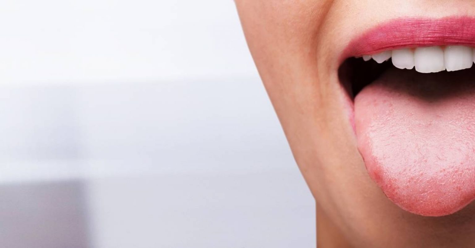 12 Reasons Why Your Tongue Is Green & How To Treat It Safely