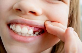 my child has big front teeth