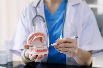 What Are Dental Spacers For Teeth? Ultimate Guide