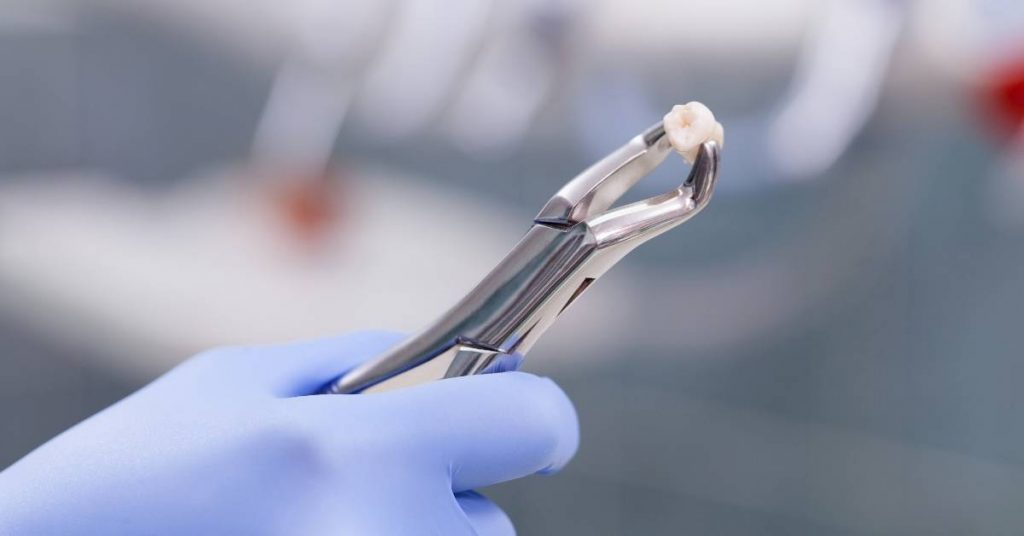a gloved hand holding dental forceps gripping an extracted tooth, possibly indicating post-extraction care or infection risk.