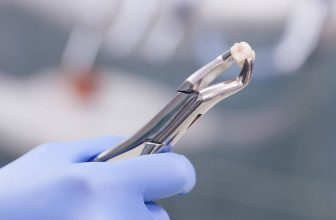 What Happens To The Abscess After Tooth Extraction? Ultimate Guide