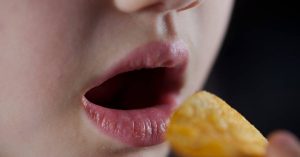 can you eat chips with braces?