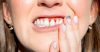 Do Your Gums Hurt When Chewing? Here Is Why & How To Treat It!