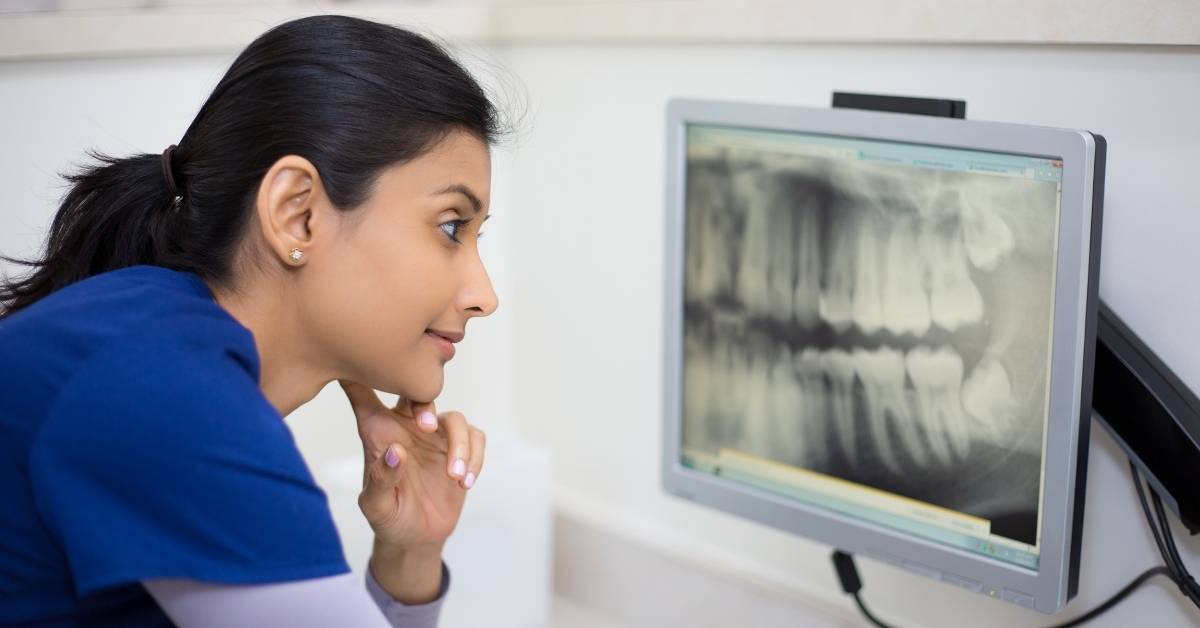 3D Dental Xrays vs 2D Dental Xrays Main DIfferences! 2024