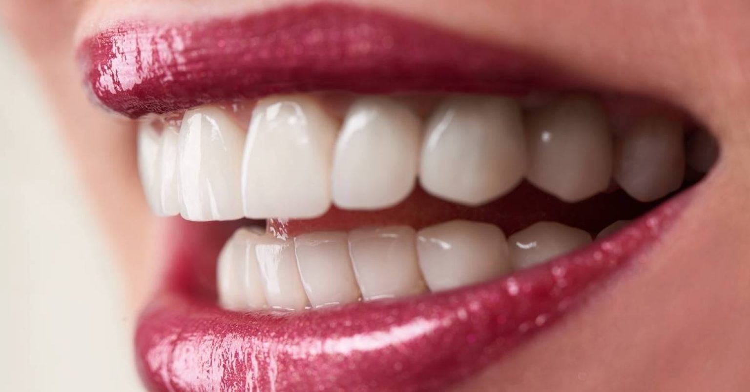 Tooth Splinting Can Help Save Loose Teeth Ultimate Guide