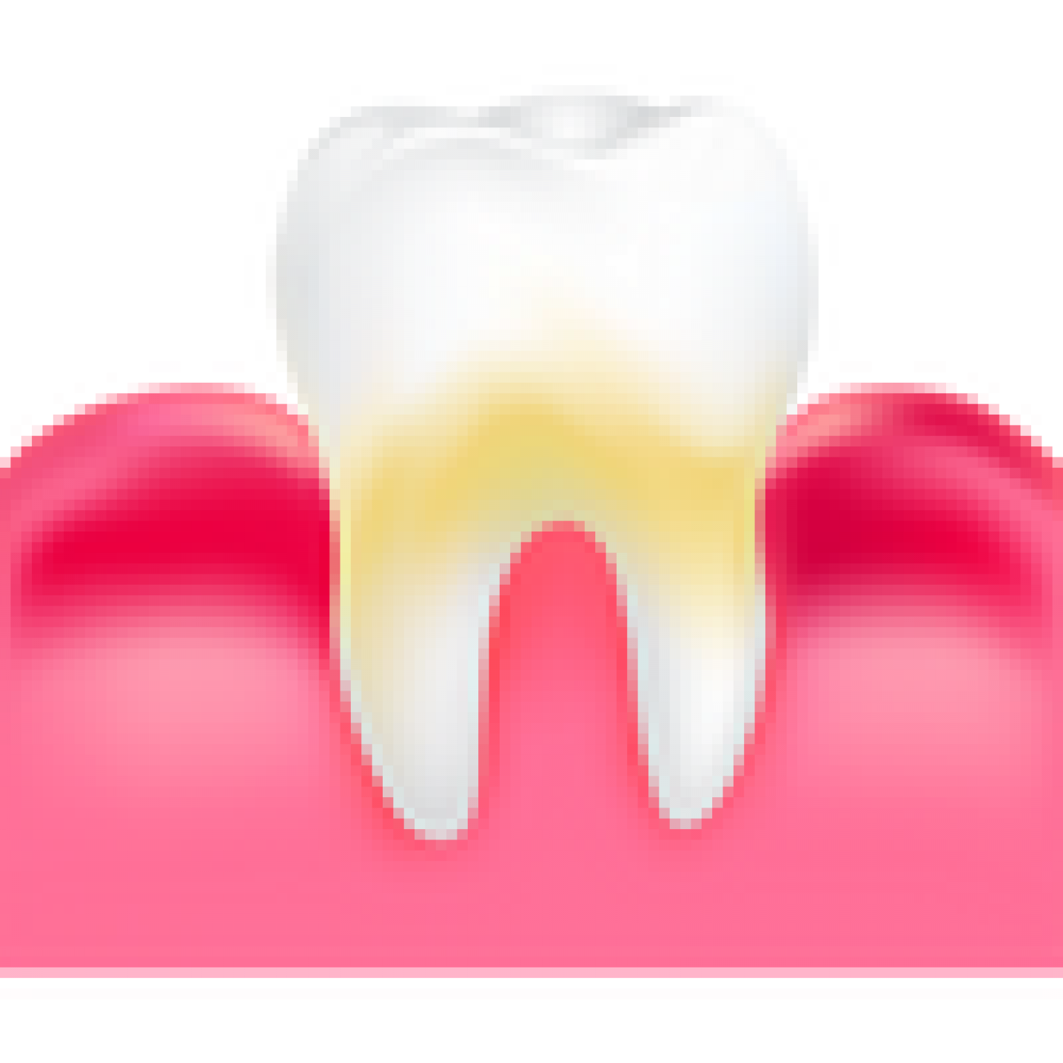 Laser Gum Treatment Is The Best Solution For Gum Disease!