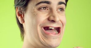 7 Main Causes Why Your Teeth Are Falling Out & What You Need To Do To Treat It!