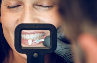 Teeth Veneers Pros And Cons Of This Dental Treatment! Are they right fit for your needs?