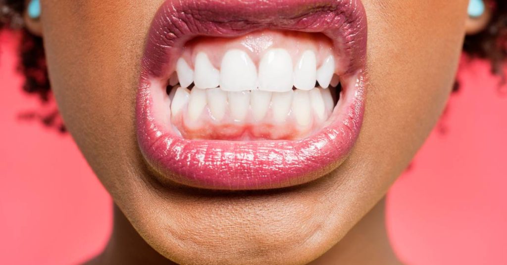 a person’s open mouth showing well-aligned teeth and lips, highlighting potential bite alignment after orthodontic treatment.