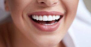 a close-up of a smiling person showing straight, bright white teeth and healthy gums
