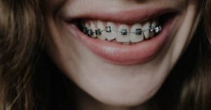 a smiling person wearing metal braces on their teeth
