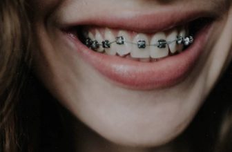 Brace Yourself: How to Give Hickeys with Braces