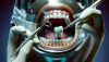 Loose Filling Symptoms: How to Spot and Treat Dental Issues Early
