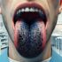 What Does Lumps on Your Tongue Mean? Learn Causes and Prevention Today