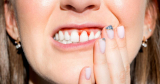 Do Your Gums Hurt When Chewing? Here Is Why & How To Treat It!