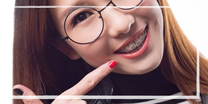 Power Chain Braces 1 How To Put Power Chains Back On Braces At Home | Guide