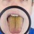Not Brushing Your Teeth at Night? Risks and Remedies